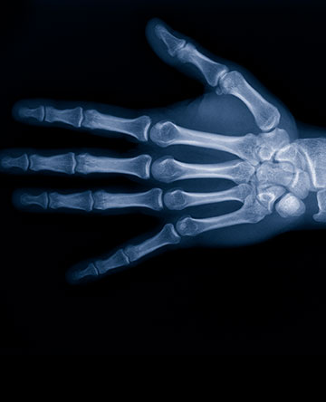 Hand, Wrist, & Elbow